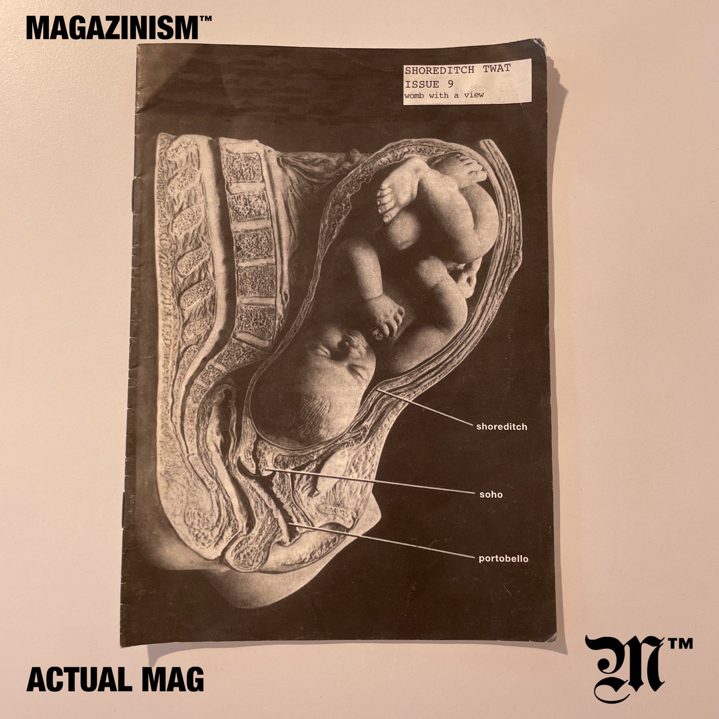 Shoreditch Twat 9 2000s