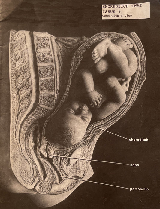 Shoreditch Twat 9 2000s